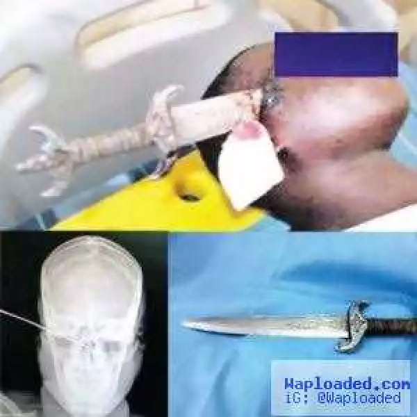 How A Tricycle Driver Was Stabbed On The Head By Passenger In Abuja (See Photos)
